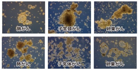 がん組織由来培養細胞f Pdo を用いた抗がん物質評価解析受託サービス 和研薬株式会社 受託オンライン Wakenyaku Co Ltd Commissioned Research Online